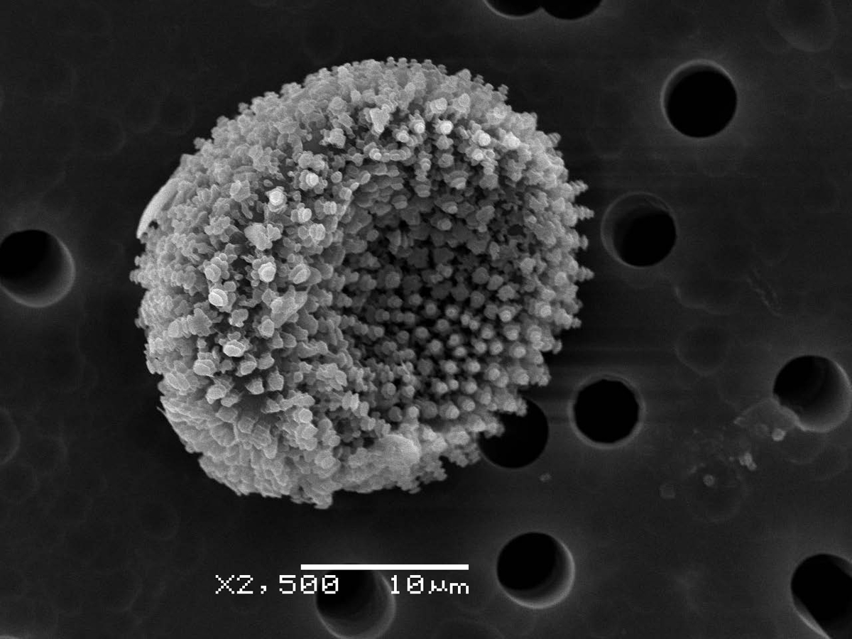 Патогенные грибы споры. Бактерии под электронным микроскопом. Грибы электронная микроскопия. Грибы микроорганизмы. Споры в микроскопе.