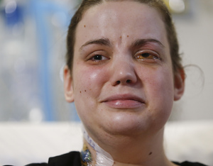 Washington mudslide survivor Amanda Skorjanc, 25, spoke from her hospital bed Wednesday about what it was like when her home was engulfed. She and her infant son Duke survived. Dan Bates/The Herald/AP