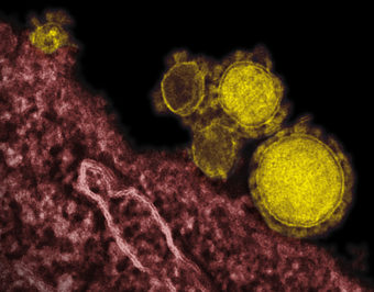 This undated file electron microscope image made available by the National Institute of Allergy and Infectious Diseases - Rocky Mountain Laboratories shows novel coronavirus particles, also known as the MERS virus, colorized in yellow. AP