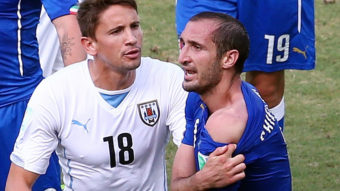 Giorgio Chiellini of Italy pulls down his shirt to show a wound after clashing with Luis Suarez of Uruguay (not pictured). After Suarez was suspended for four months over his biting of Chiellini, the Italian said the punishment was too harsh. Julian Finney/Getty Images