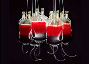 Several countries, including Australia, Japan and Great Britain, already encourage blood donations from some gay men. (Photo by Kevin Curtis/Getty Images/Science Photo Library)