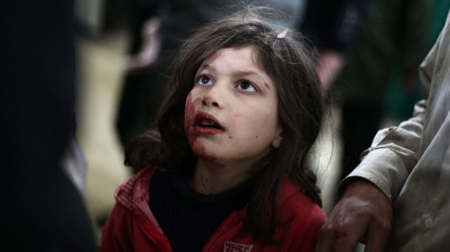 Image syria-girl-wounded_wide-5aaad1f7547126162f04d0975a0af0b943d27b7b-s1000.jpg
