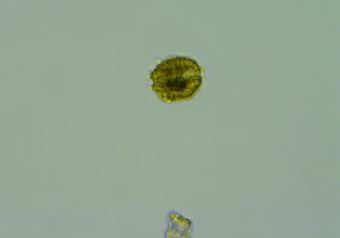 Alexandrium is a genus of dinoflagellates that leads to Paralytic Shellfish Poisoning. This cell was identified by a team of researchers at NOAA’s biotoxin testing lab in Seattle. (Photo courtesy of NOAA).