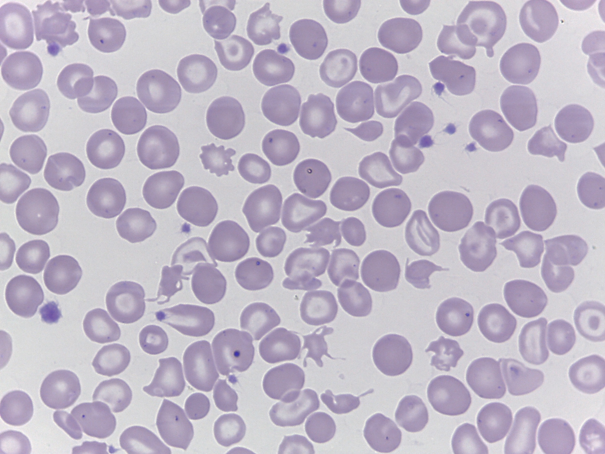 A blood smear at the Petersburg lab shows anemia. (Photo courtesy of Liz Bacom)
