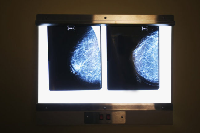 A change in mammography guidelines could affect their cost for many women. Robert Llewellyn/Corbis
