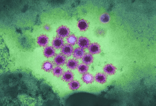 If you're at high risk of hepatitis B infection, your insurance company should pay for testing for the virus without passing any of the cost on to you. London School of Hygiene and Tropical Medicine/Science Source