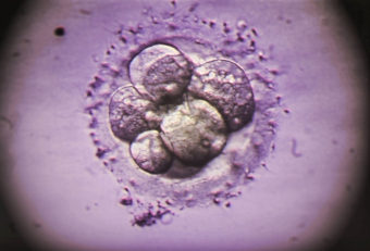 It's now possible to edit the DNA in a human embryo. The next question is, should we? Zephyr/Science Source