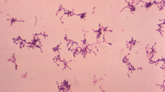 The purple-stained Rothia dentocariosa bacteria are frequently found in the human mouth and respiratory tract. CDC