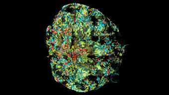 Image of a mini-kidney formed in a dish from human induced pluripotent stem cells. Minoru Takasato/Nature