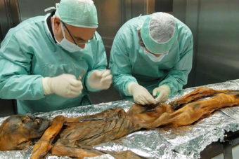 The stomach of Oetzi, who was mummified in ice, was home to bacteria that scientists were able to identify. The same species lives in the gut of many modern humans. EURAC/Marion Lafogler