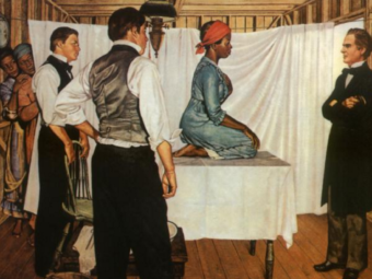 Illustration of Dr. J. Marion Sims with Anarcha by Robert Thom. Courtesy of Southern Illinois University School of Medicine, Pearson Museum. Pearson Museum, Southern Illinois University School of Medicine