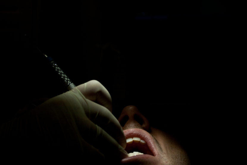 dentist teeth cleaning