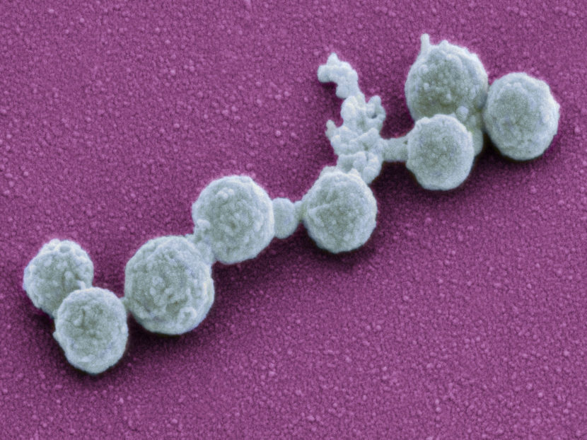 In 2010, scientists plopped the genetic material of one Mycoplasma bacterium into another type to create the self-replicating cells shown above. Six years later, they've come out with an even simpler synthetic organism that has fewer genes. (Thomas Deerinck, NCMIR/Science Source)