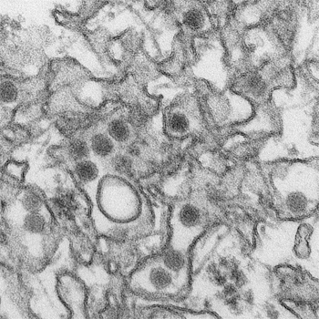 The Zika virus, magnified. (Photo by Cynthia Goldsmith/Centers for Disease Control)