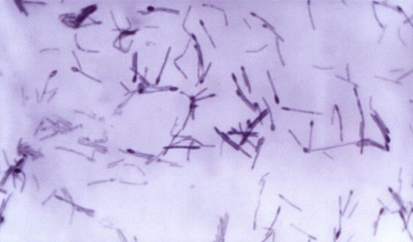 Bacteria that causes botulism.