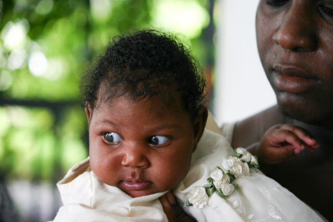 Chinashama Sainvilus is one of three babies born with microcephaly at the Mirebalais Hospital in Haiti in July.(Photo by Jason Beaubien/NPR)