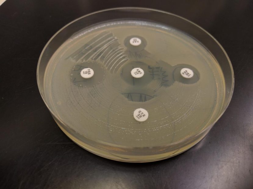 A test for antibiotic resistance. The cloudy film on the petri dish surface are E. coli bacteria and the little white discs contain different antibiotics. If the E. coli are resistant to the antibiotic, they grow right up to the edge of the white disc. If the disc has a little "halo" around it, that means the E. coli are susceptible to the antibiotic.