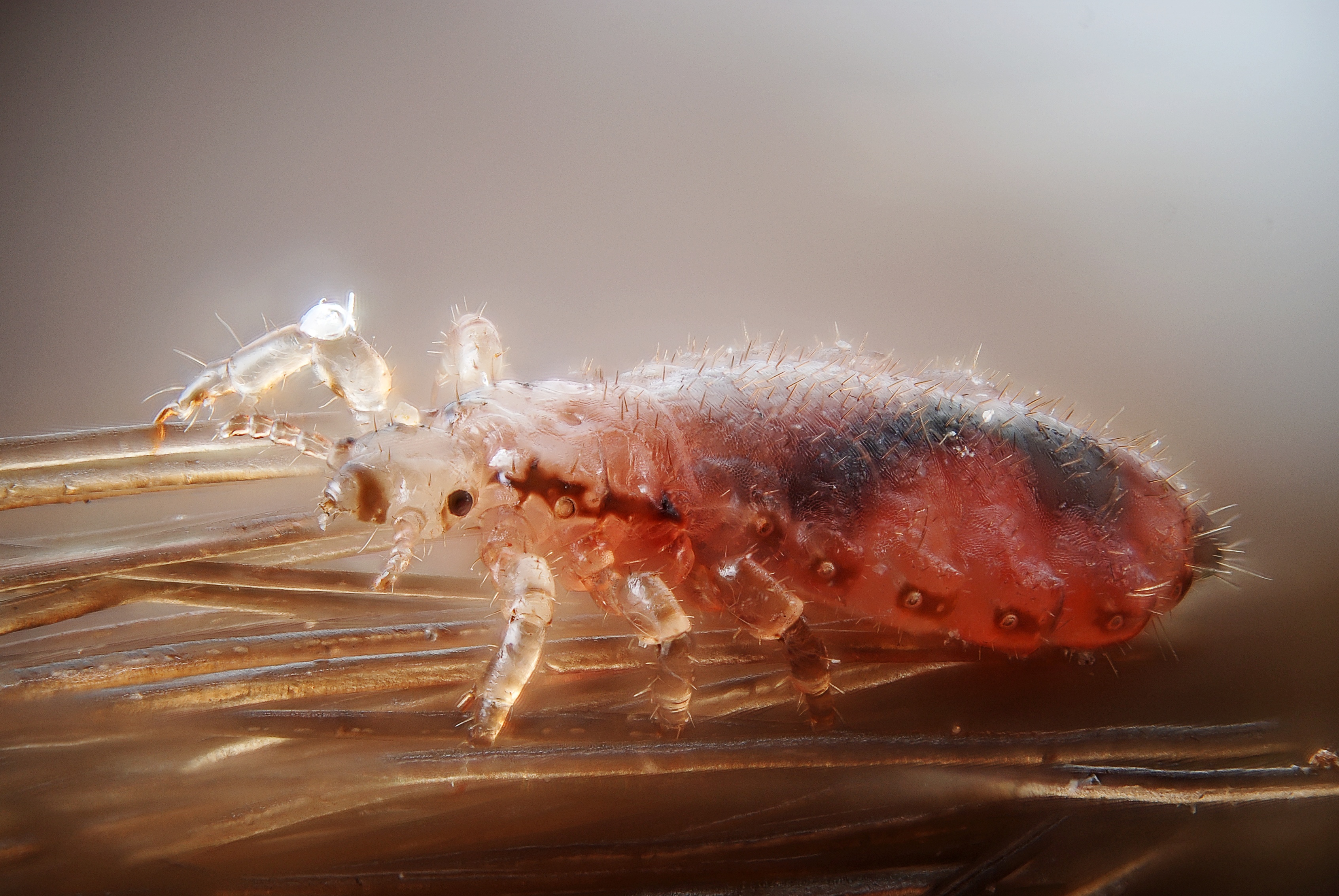 Are there head lice in Juneau schools? Yes, but ...