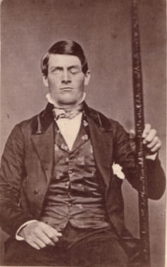 Cabinet-card portrait of brain-injury survivor Phineas Gage (1823–1860), shown holding the tamping iron which injured him.