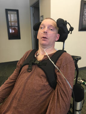 Travis Finkenbinder, pictured here on March 14, 2018, is permanently minimally conscious. A coworker struck him in the head with his float plane's ski in 2014.