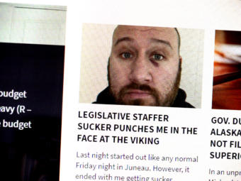 Blogger Jeff Landfield of The Alaska Landmine posted this photo of himself on on March 23, 2019. He says a legislative staffer gave him the black eye in a bar in Juneau on March 22, 2019.