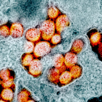 This transmission electron microscope image shows particles of SARS-CoV-2, the coronavirus that causes the disease known as COVID-19. (Image courtesy of National Institute of Allergy and Infectious Diseases Integrated Research Facility)