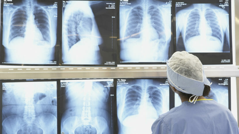 A health care worker studying chest images