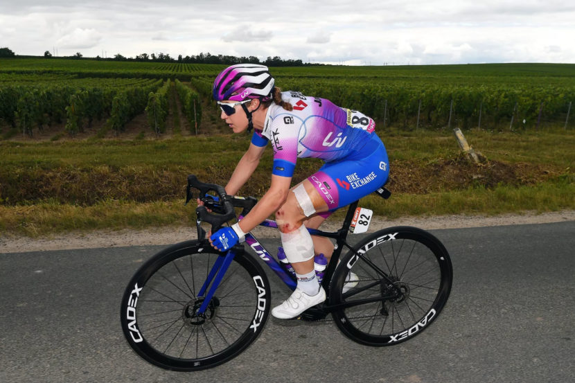 A woman on a road bike in face kit, with injuries to her left leg